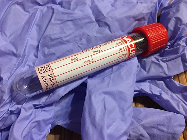 Blood Sample